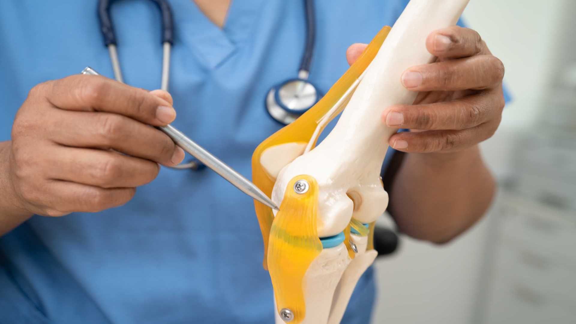 Thoái hoá khớp háng ở mức độ hai có cần phải thay khớp không?